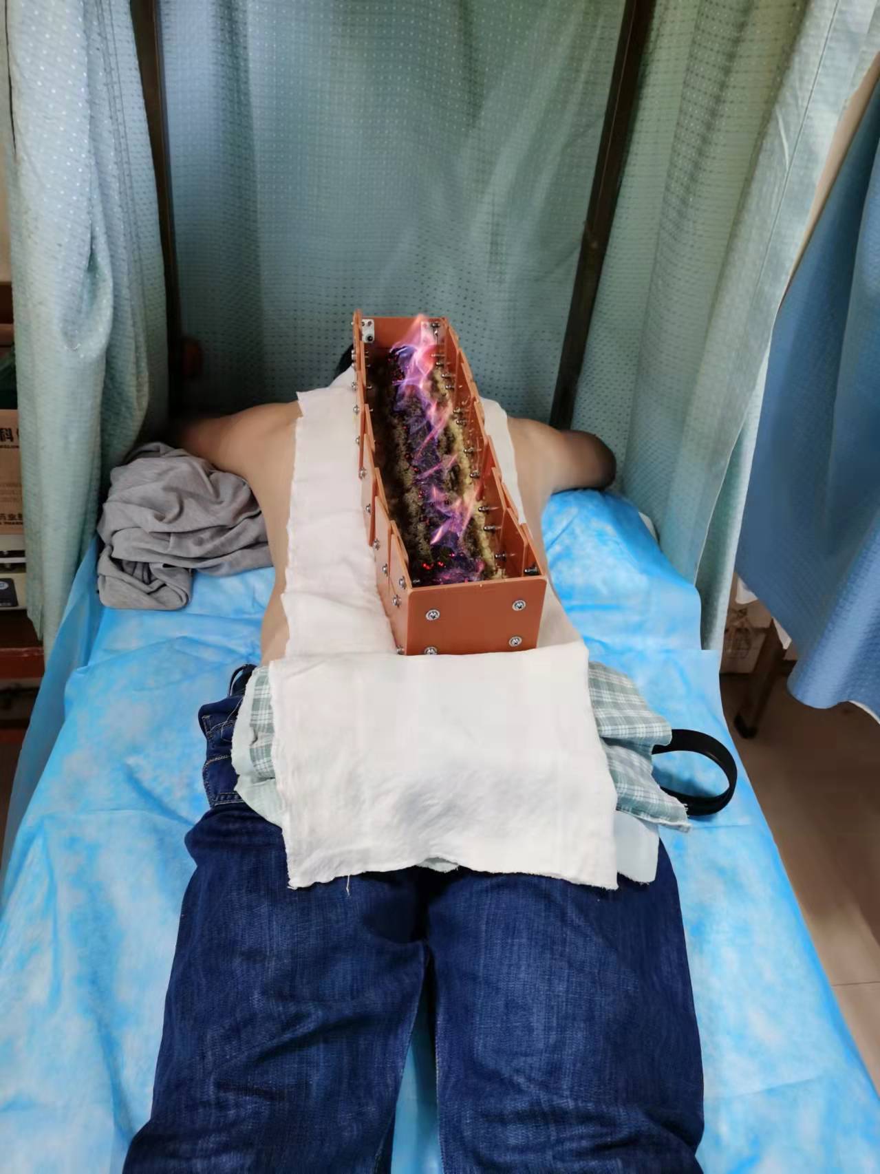 督灸2.jpg